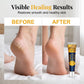 🦶 Intensive Moisturizing Foot Cream | Deep Hydration for Dry, Rough & Cracked-Looking Heels