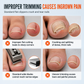 🔥Stainless Steel Ingrown Toenail Clippers